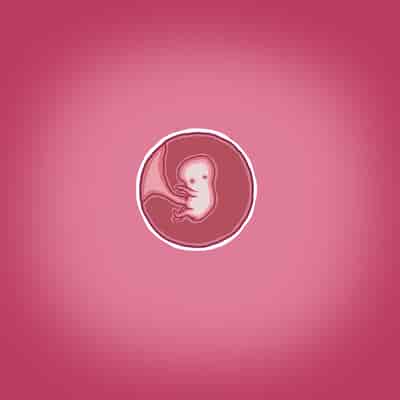 [Straw] Yumi's Study Abroad 由美的留学生活（汉化）（连载中）