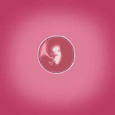 [Straw] Yumi's Study Abroad 由美的留学生活（汉化）（连载中）